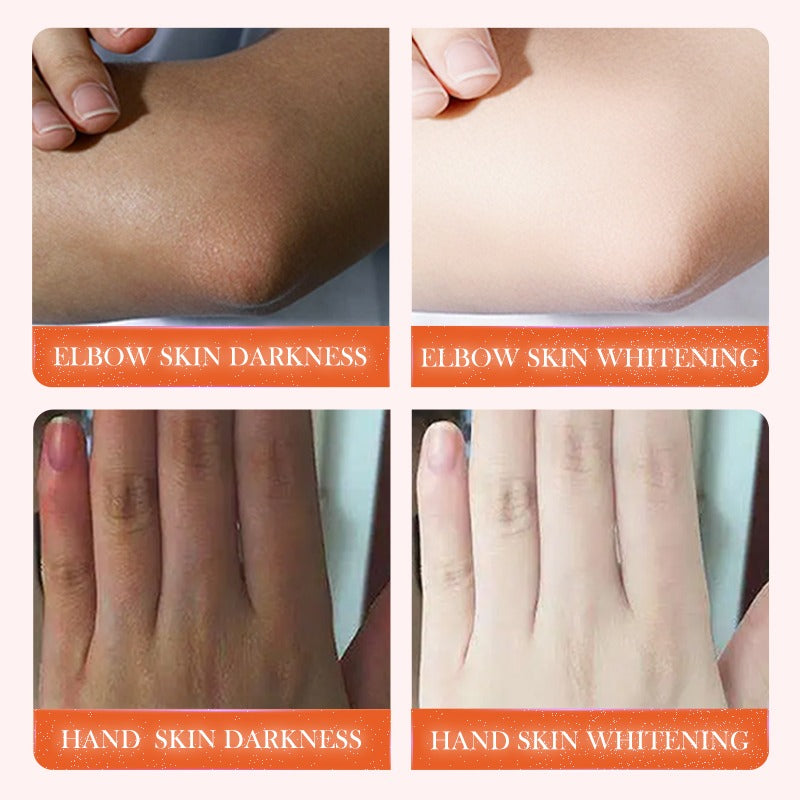 SADOER Dark Knuckle Whitening Niacinamide Vitamin C Body Serum 50ml